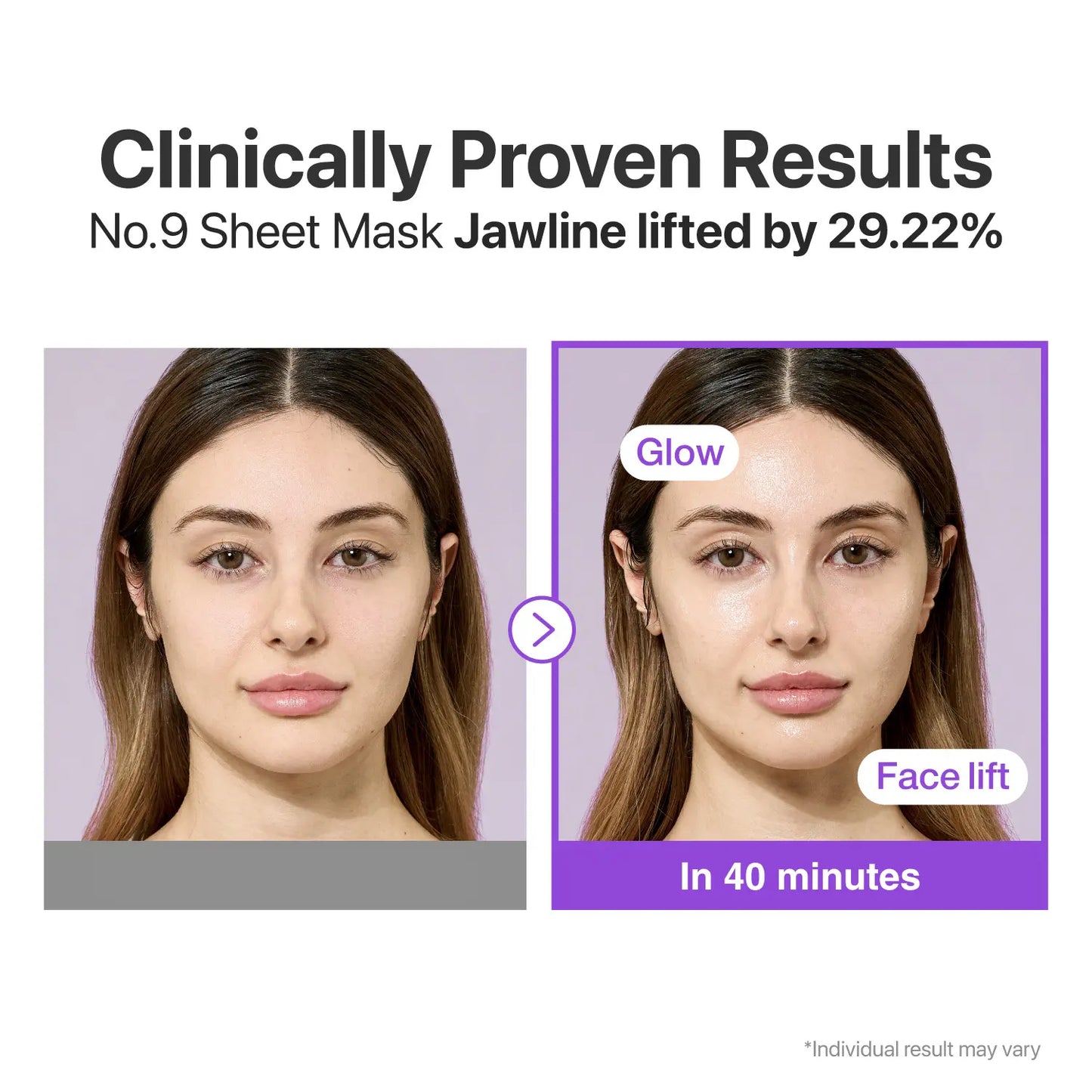 [Numbuzin Official Shop] No.9 NAD+ Lifting Sheet Mask | NAD+ BIO Lifting-Sil Full Face Mask | 4 Sheets+Lifting Band | for Face Lifting, Jawline, Double-Chin, Neck, V-Line | 50 Peptides & NAD+ & Collagen