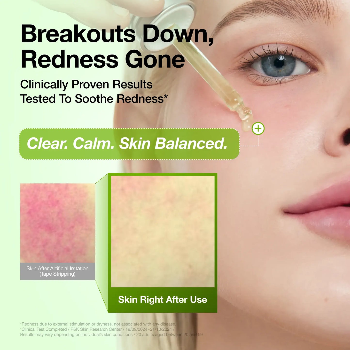 [Anua Official Shop] Anua Serum Discovery Set: Perfect Quad of Serums for Glass Skin | Discoloration, Niacinamide Serum, Azelaic Acid, Hyaluronic Acid