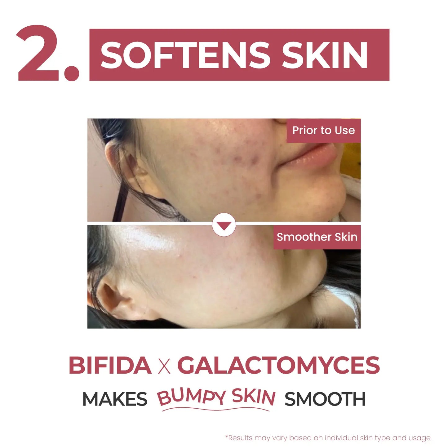 [Numbuzin Official Shop] No.3 Serum | Skin Softening Serum | Pores, Textured, Bumpy, Rough to Glass Skin | Bifida, Galactomyces, Niacinamide, Adenosine, Panthenol | 1.69 Fl. Oz.