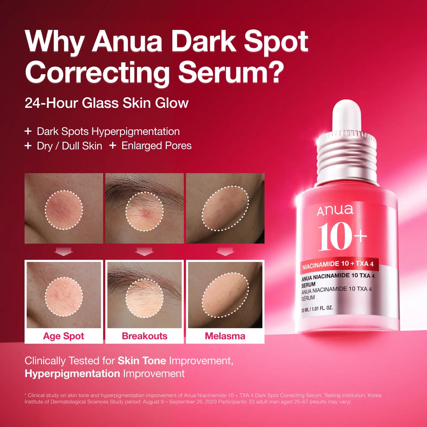 [Anua Official Shop] Anua Serum Discovery Set: Perfect Quad of Serums for Glass Skin | Discoloration, Niacinamide Serum, Azelaic Acid, Hyaluronic Acid