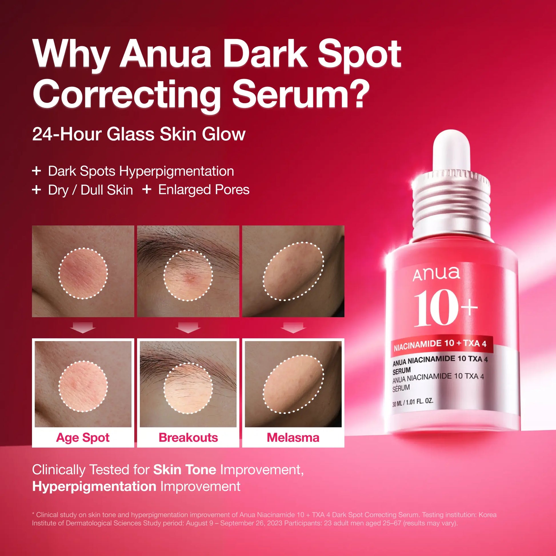 [Anua Official Shop] Anua Serum Discovery Set: Perfect Quad of Serums for Glass Skin | Discoloration, Niacinamide Serum, Azelaic Acid, Hyaluronic Acid
