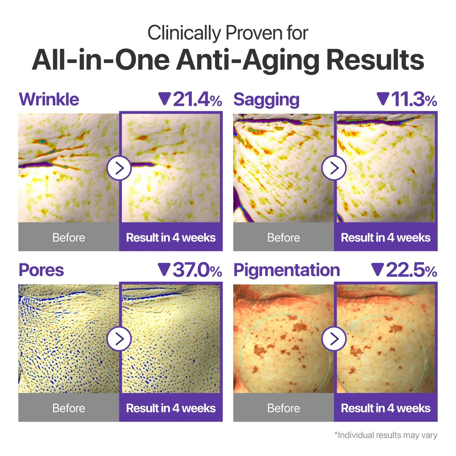 [Numbuzin Official] No.9 NAD+ Retinal Volumetox Eye Cream Duo Set | All-In-One Anti-Aging Treatment for Wrinkles, Fine Lines, Dark Circles & Dark Spots | NAD+, Retinal, 50 Peptides, Niacinamide, Ceramides | Face to Body, Skin Longevity | 20 Ml * 2EA